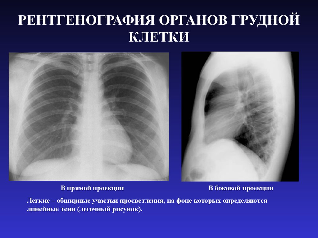 Изображение органов на рентгенограммах является